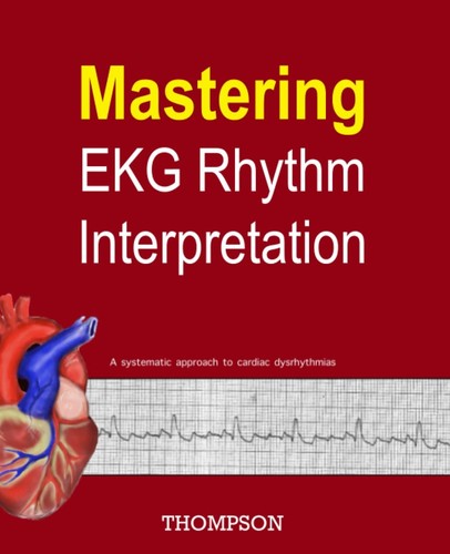 Mastering ekg rhythm - ekg,