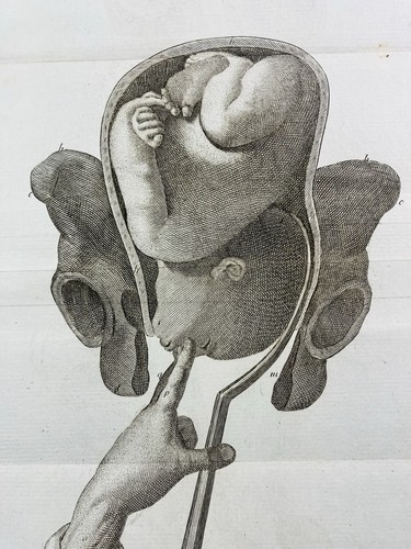 Medico ostetricia 1807 - medico, in