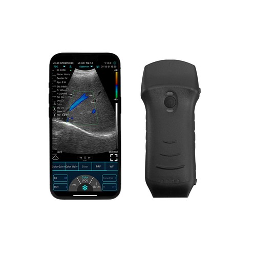 Konted ultrasuoni portatile - konted,