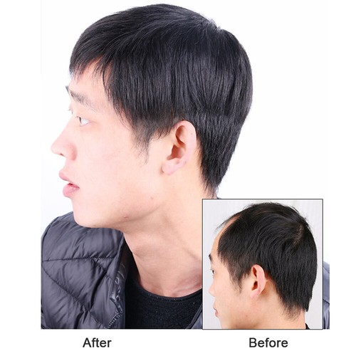 Toupee capelli umani - , sottili