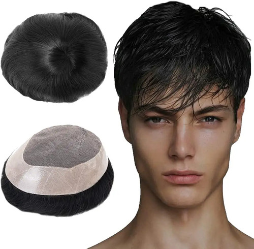 Protesi capelli maschile - protesi,