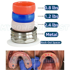 Localizzatore di sovradensi