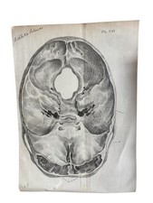 19thC Lithograph Of Athletic
