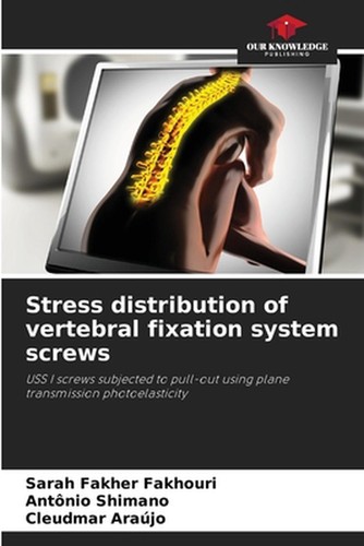Stress distribution - , of