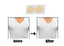 5prs Patch per Adesivi per