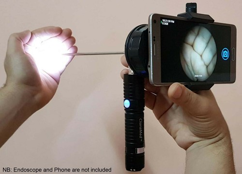 Adattatore per endoscopio