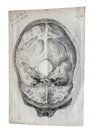 19thc lithograph female skull - 19thc,