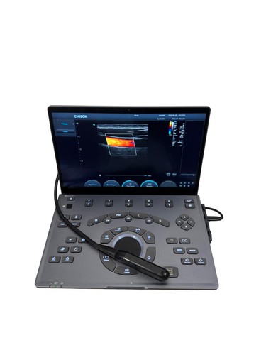 Color doppler ultrasuoni - color,