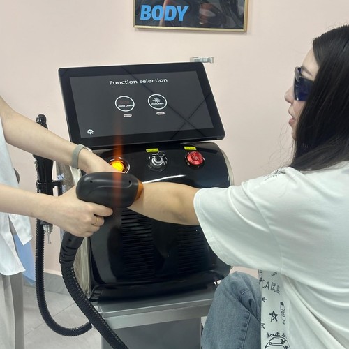 Macchina rimozione tatuaggi