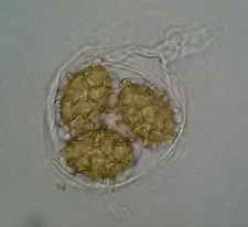 TARTUFICOLTURA COLTIVAZIONE