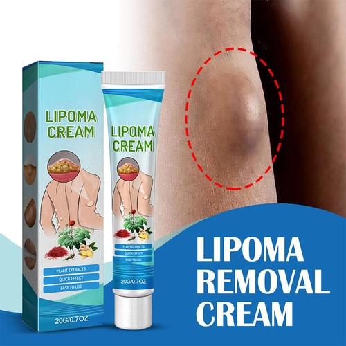 Lipoma crema lenitiva - lipoma,