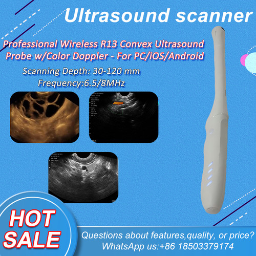 Sonda ultrasuoni doppler - , a