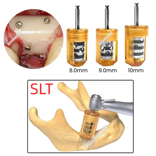 Dentale easy collector tecnica - dentale,