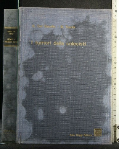 Tumori della colecisti del - colecisti.,