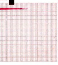 Ecg paper 90mmx70mmx400sheets - ecg,