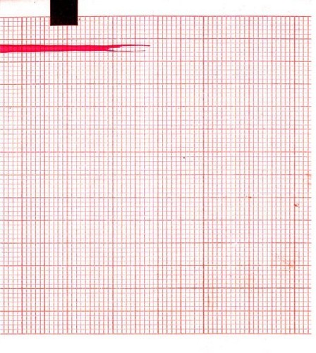 Carta ecg 90mmx70mmx400fogli - carta,