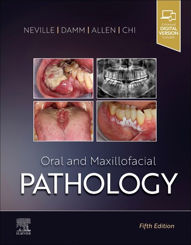 Oral and maxillofacial - oral,