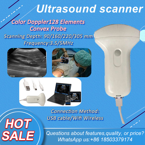 Scanner sonda ultrasuoni