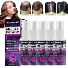 Minoxidil 1-5 mesi 2% extra