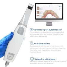 Scanner intraorale dentale - scanner,