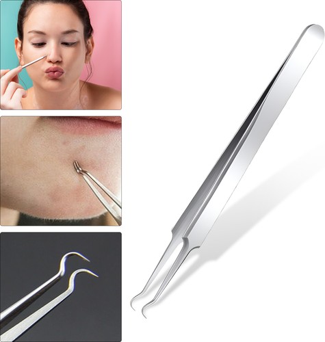 Acne punti neri - punti, solvente