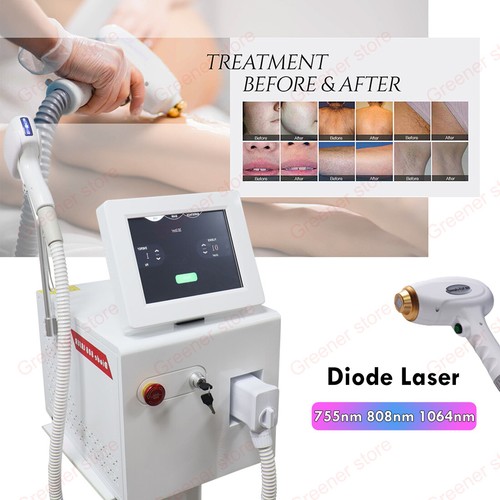 New diode laser permanent - new,