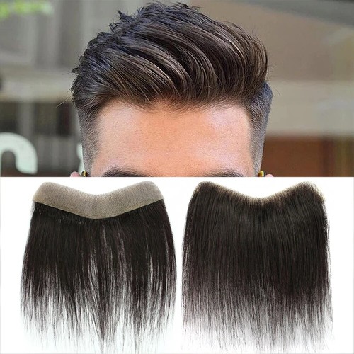 Toupee uomo anteriore - , 100%
