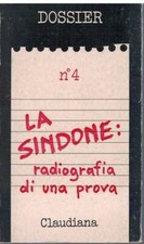 La Sindone: radiografia di una