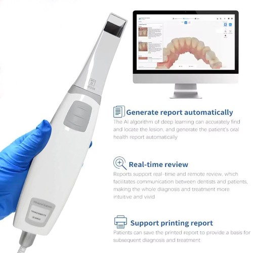 Scanner dentale intraorale - scanner,