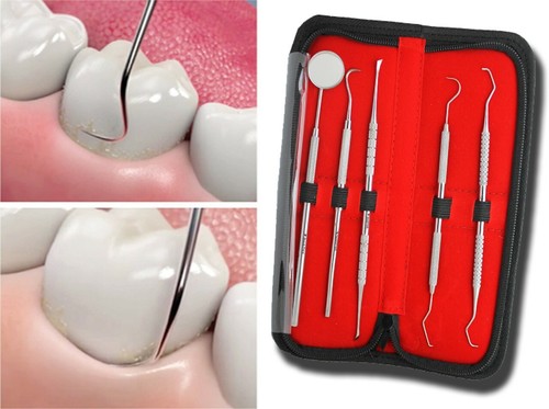 Kit sbiancamento denti - kit,