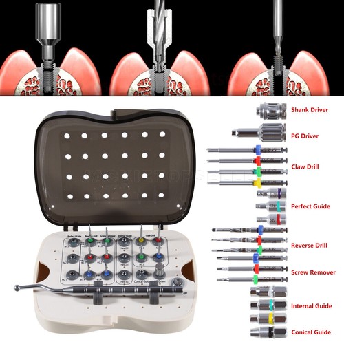 Dentale dentista broken - x,