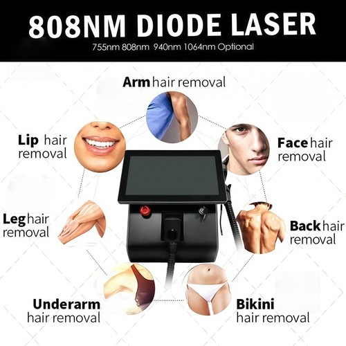Macchina depilazione laser