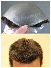 Capelli sostituzione pelle