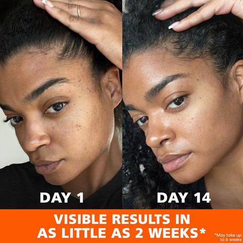 Skin success crema - success,