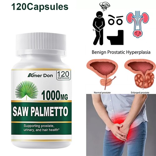 Saw palmetto 1000mg supporto - saw,