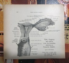 Lotto 2 Stampe Anatomiche Utero Trombe Ovati Vagina H.Unger Werner Spalterholt 