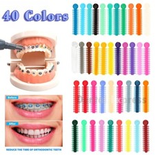 1040 Fascette Elastiche per