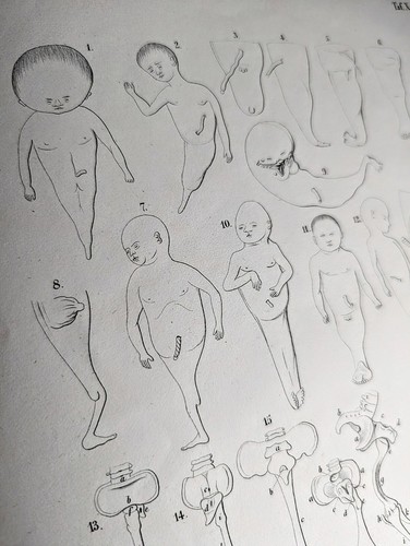 1865 the malformations - the,