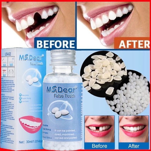 Kit riparazione denti - riparazione,
