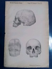 1881 _ LITOGRAFIA DI TESCHIO
