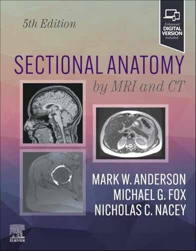 Sectional anatomy mri and - by,
