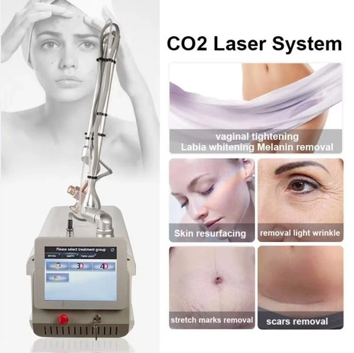 Macchina per trattamento laser
