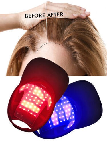 Cappellino crescita capelli