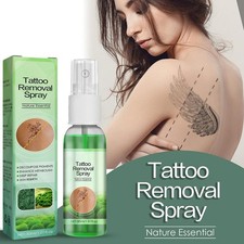 Crema Rimozione Tatuaggi