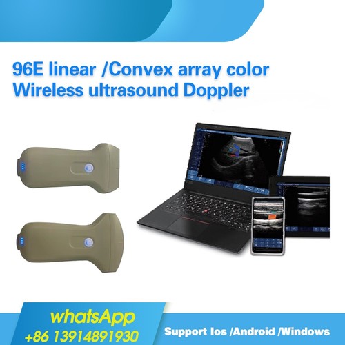 Connessione wifi usb - connessione, wireless