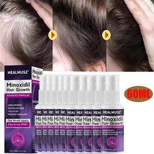 Minoxidil 2% Extra Forte Donna