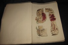 1839 fasc 27 cruveilhier - 26,