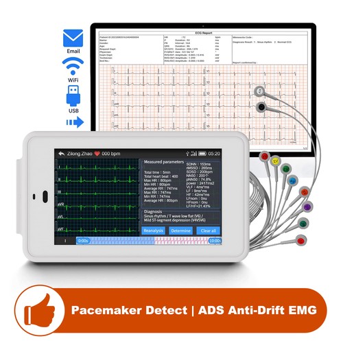Macchina ecg mobile cavi - macchina,