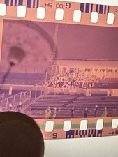 NEGATIVO FOTOTIFO ULTRAS