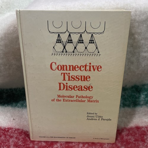 Connective tissue disease - tissue,